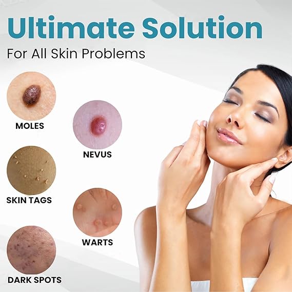 Non-Invasive Acne & Wart Removal Laser Pen with Heating (No Side Effect)
